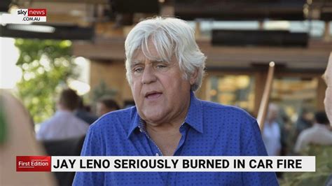 jay leno|jay leno burned in fire.